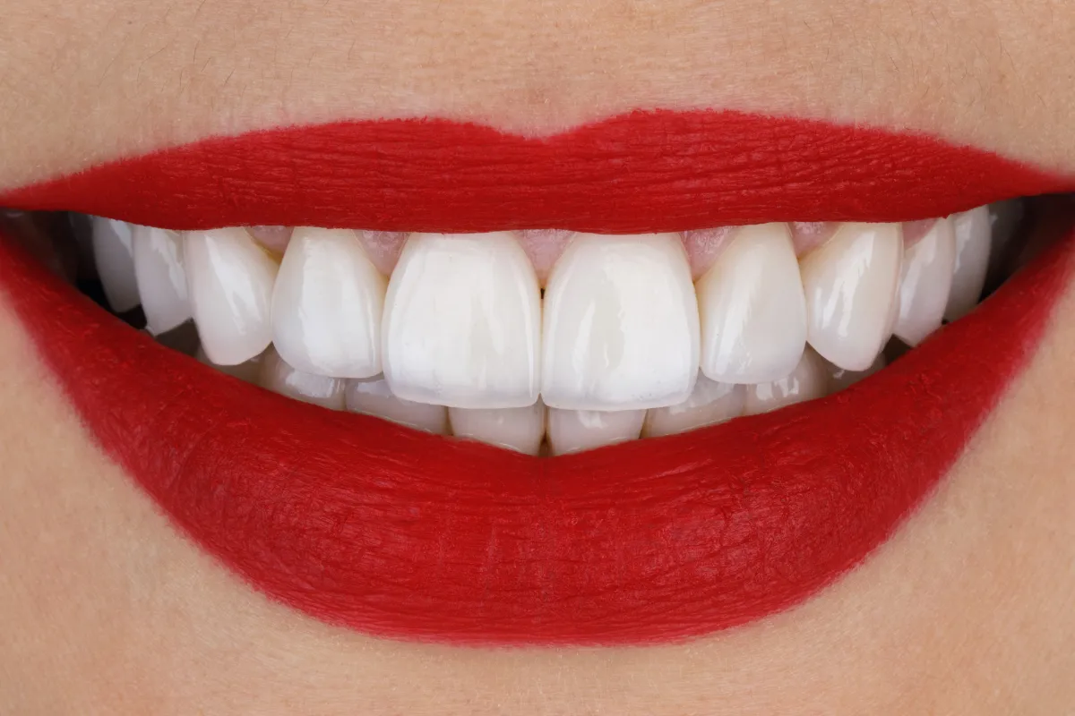 The Power of a Smile: Tips for Healthy Teeth and Lips